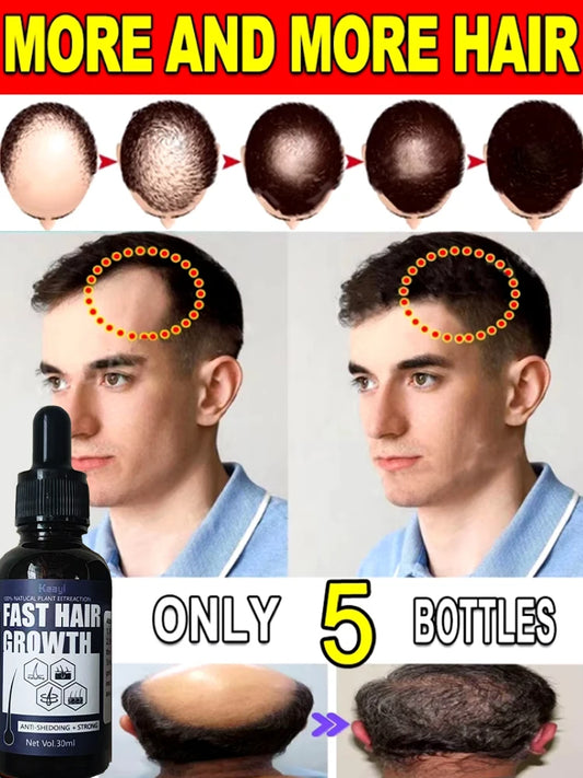 Spray Solution To Regrow Hair, Thicker & Fuller